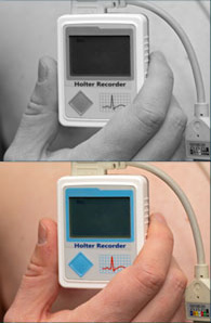 Cardiac Monitors