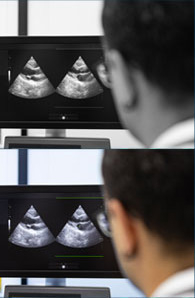 Cardiovascular Ultrasound