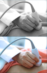 Echocardiogram