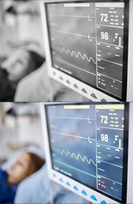 Electrocardiogram
